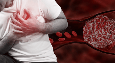 The Microclot Scandal: What the System Won't Test For, Won't Treat, Won't Even Acknowledge